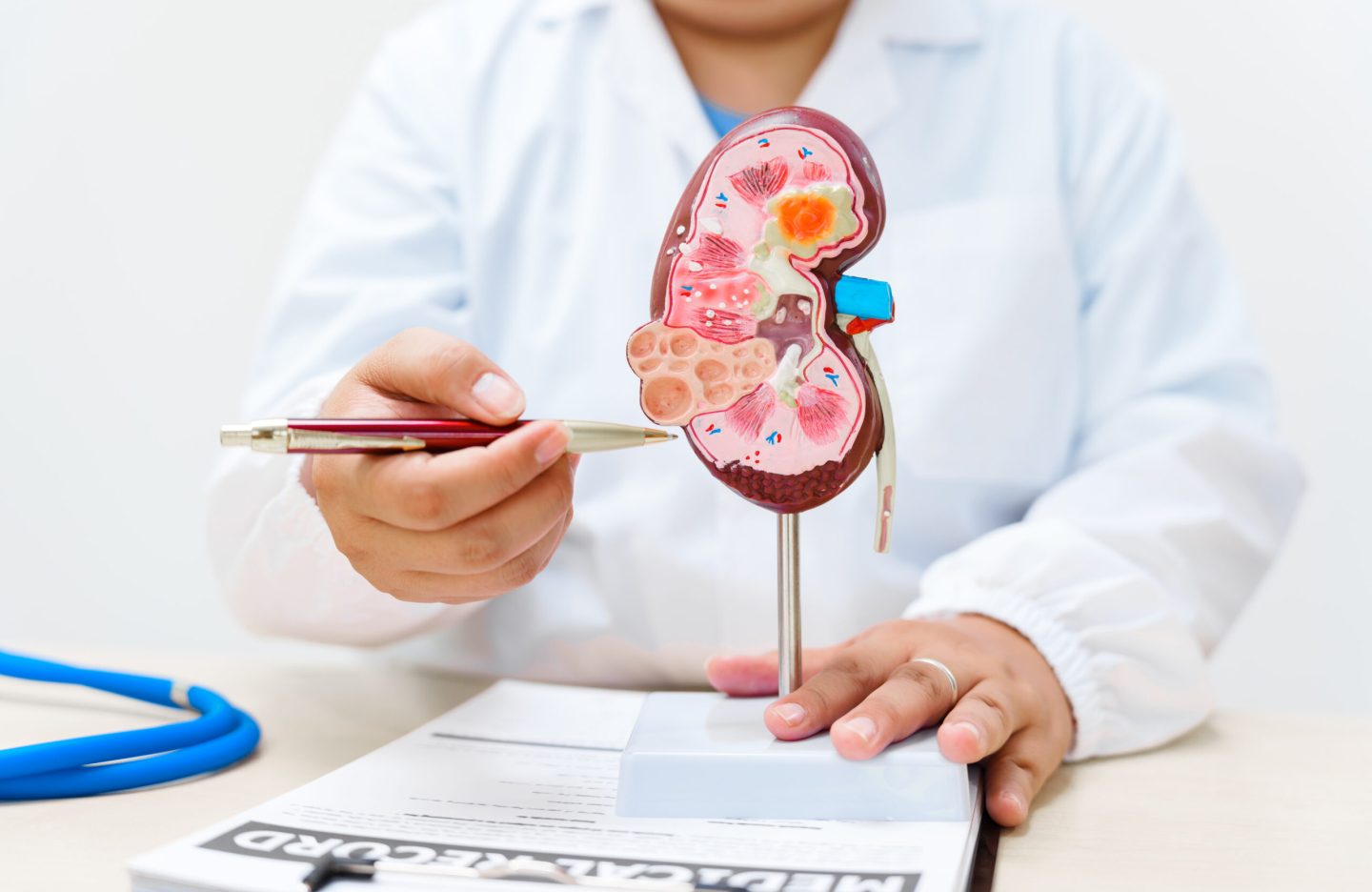 A doctor uses an anatomical kidney model to explain renal diseases, treatments, and diagnostics
