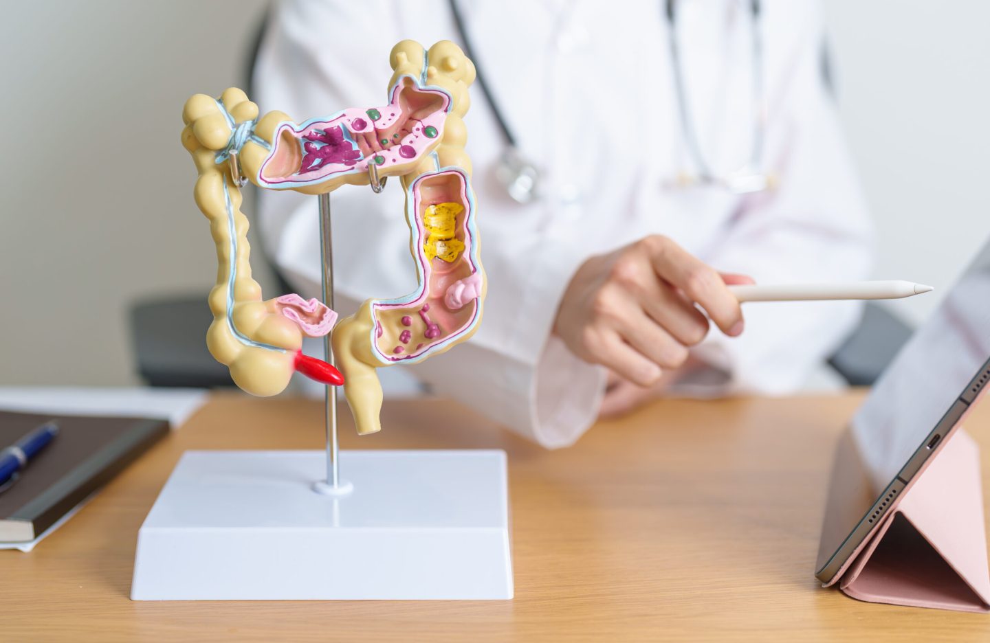 Doctor with human Colon anatomy model and tablet. Colonic disease, Large Intestine, Colorectal cancer, Ulcerative colitis, Diverticulitis, Irritable bowel syndrome and Digestive system